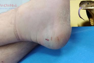 Nằm Mơ Thấy Rắn Cắn Vào Chân : Biểu Tượng, Điềm Báo & Giải Mã Con Số May Mắn
