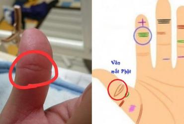 Xem Trên Tay Bạn Có Vân Mắt Phật Không?