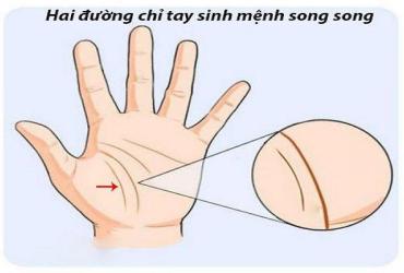 Đường Chỉ Tay Có Hai Đường Sinh Mệnh Là Điềm Báo Gì?