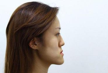 Xem Tướng Mặt Lưỡi Cày Nói Lên Điều Gì?
