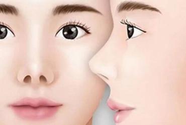 Những Tướng Mũi Xấu - Đặc Điểm Tính Cách và Lời Khuyên Hữu Ích