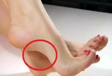 10 Tướng Bàn Chân Phụ Nữ Thể Hiện Về Già Giàu Có và An Lành