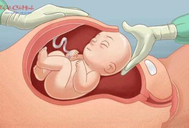 Xem Ngày Tốt Sinh Mổ: Hướng Dẫn Chi Tiết Để Mẹ Và Bé Bình An